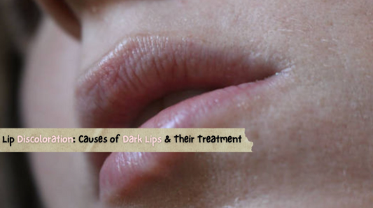 causes-of-dark-lips-and-effective-treatments